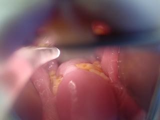 Choroby zeb�w u kr�lika