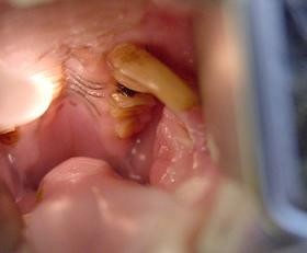 Choroby zeb�w u kr�lika